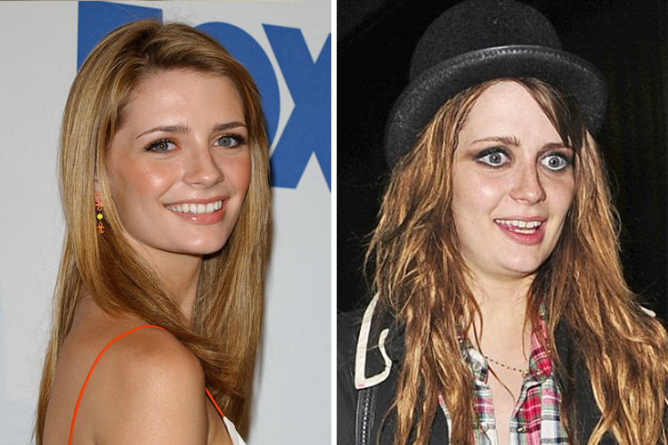 20 Shocking Photos Of Celebrities Before And After Drugs Ruined Their Lives Number 1 Is Just