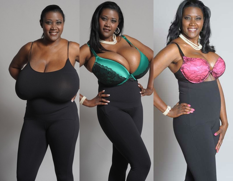 Woman with 36NNN breasts has them removed because she 'can't run or jump