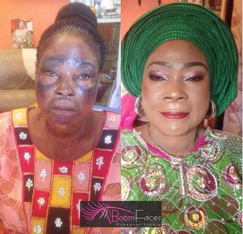 Before And After Photos: This Lady Looks Completely Unrecognizable ...